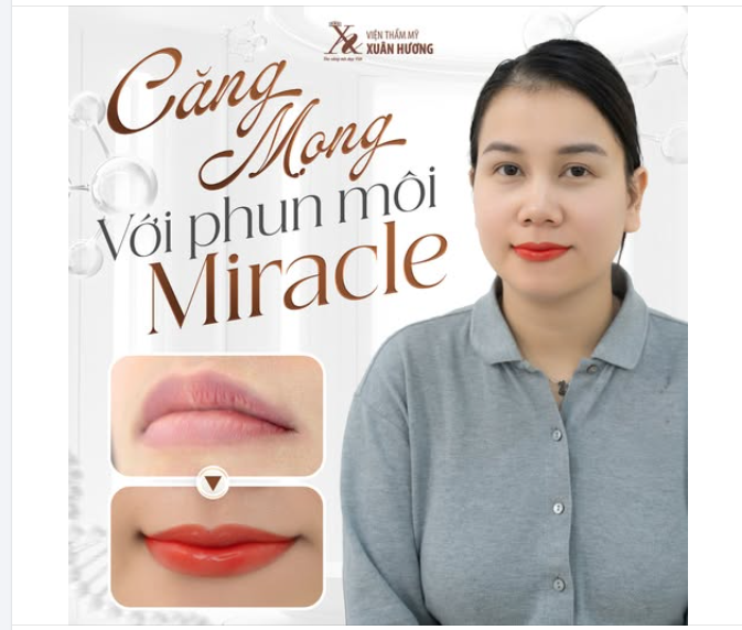 SỞ HỮU ĐÔI MÔI CĂNG MỌNG - RẠNG RỠ ĐÓN TẾT