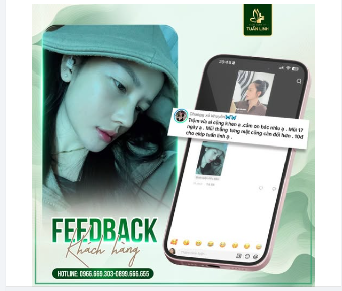 FEEDBACK NÂNG MŨI – DÁNG MŨI SAU 17 NGÀY