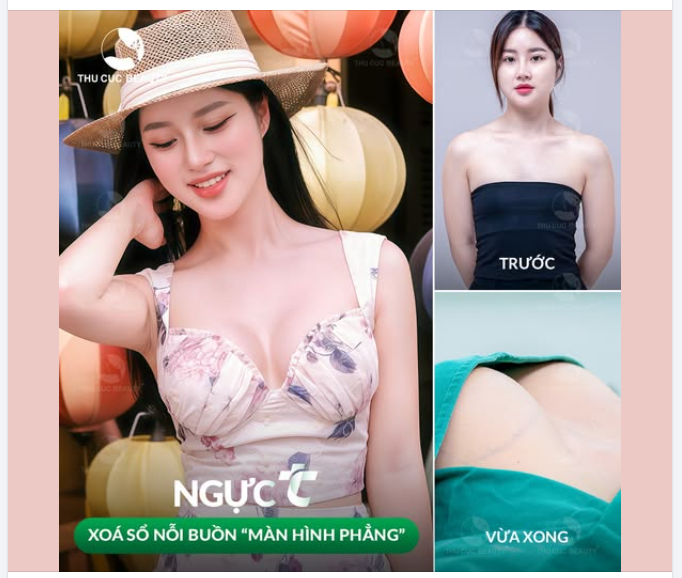 Nâng ngực tại Thu Cúc bạn sẽ nhận lại được những gì?