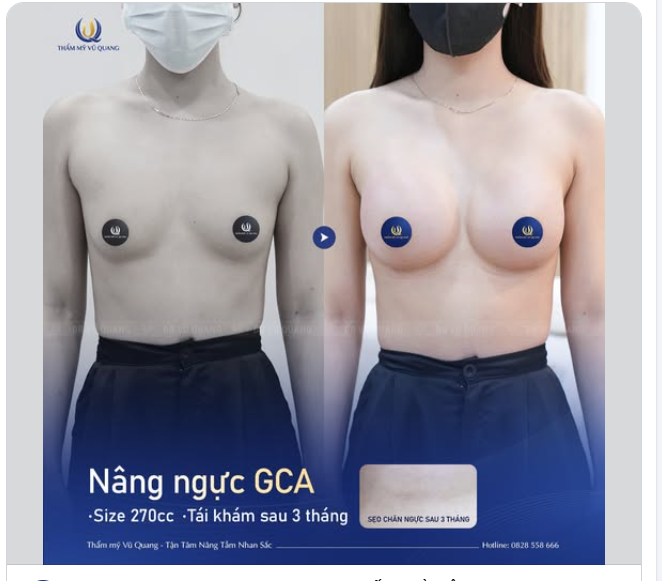 Đẹp từ từng centimet – Khe chữ X mê hoặc – Tự tin diện đầm ôm gấp bội!