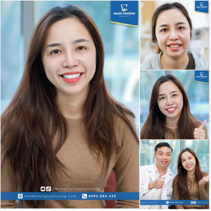 Cảm ơn chị đẹp thành Vinh đã tin tưởng Nha khoa Ngân Phượng