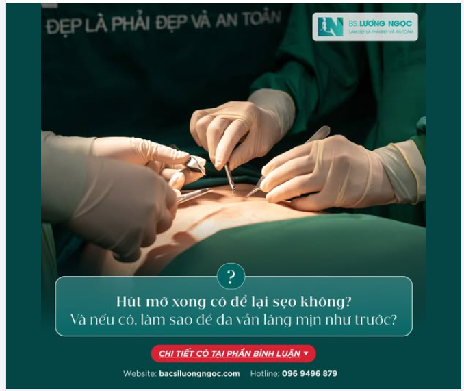 Q&A: Hút mỡ xong có để lại sẹo không? Và nếu có, làm sao để da vẫn láng mịn như trước?