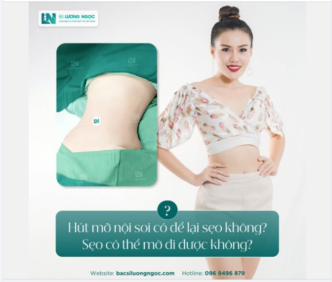 Q&A: HÚT MỠ NỘI SOI CÓ ĐỂ LẠI SẸO KHÔNG? SẸO CÓ THỂ MỜ ĐI ĐƯỢC KHÔNG?
