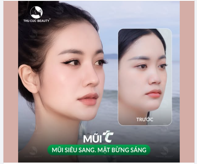 Mũi TC - Tạm biệt mũi tẹt, đón dáng mũi mới thu hút mọi ánh nhìn