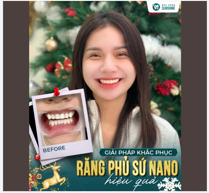 TRĂM LẦN CẢNH BÁO cũng không bằng một lần tận mắt nhìn thấy trường hợp phủ sứ Nano sau 1 thời gian sẽ hư hỏng thế nào.