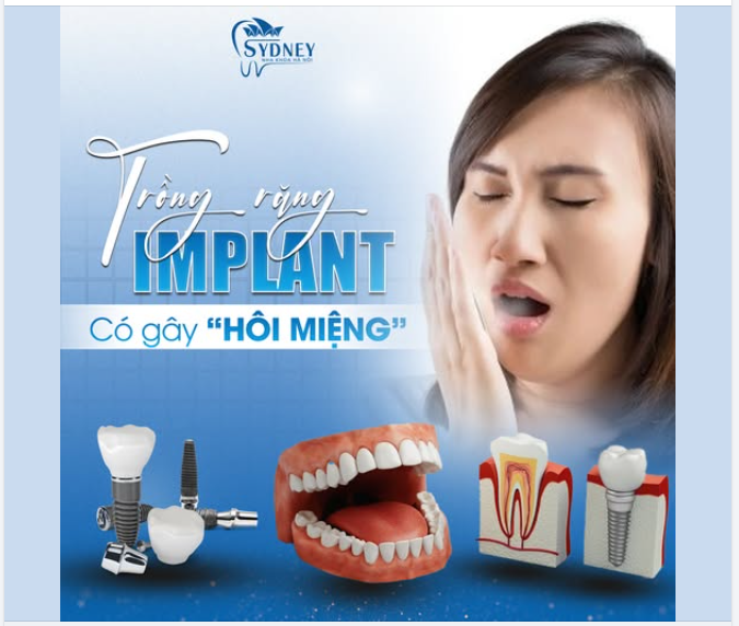 TRỒNG RĂNG IMPLANT CÓ GÂY HÔI MIỆNG?