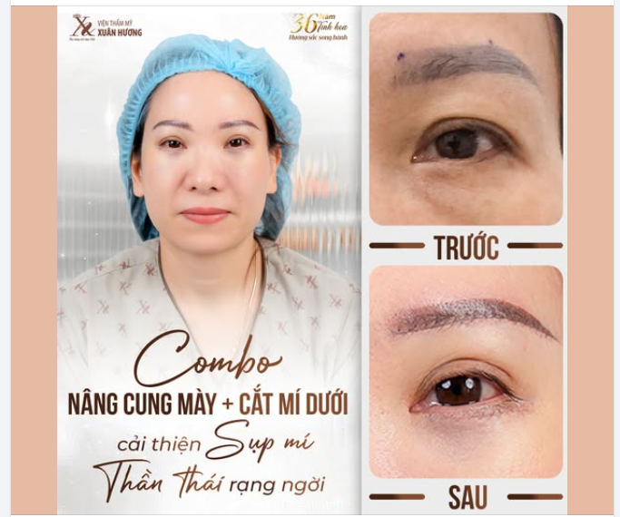 COMBO THẦN THÁNH GIÚP TRẺ HOÁ MẮT CHỈ SAU 1 LẦN THỰC HIỆN