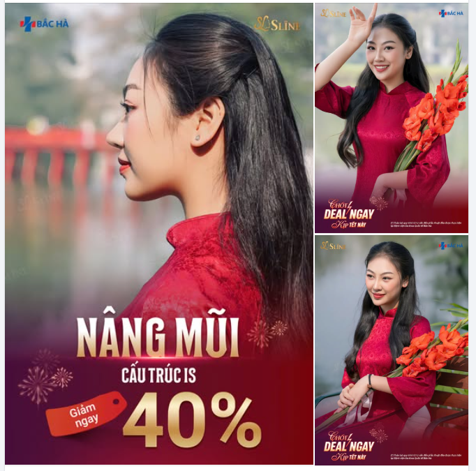 NÂNG MŨI GIẢM TỚI 40% – CHỐT DEAL NGAY KỊP TẾT NÀY