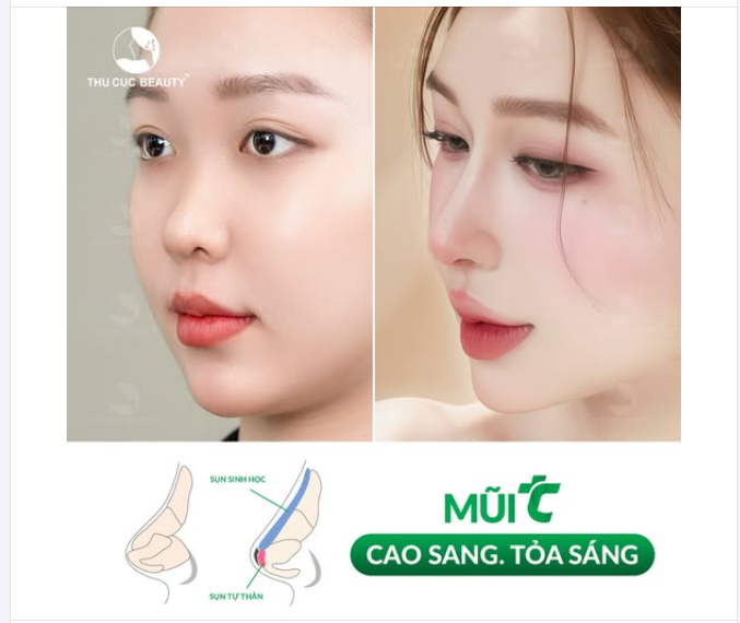 Không cần filter, chỉ cần dáng mũi mới để nâng hạng nhan sắc
