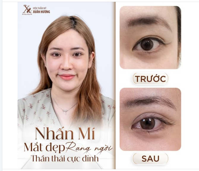 40 PHÚT NHẤN MÍ, THẦN THÁI RẠNG NGỜI BẤT NGỜ