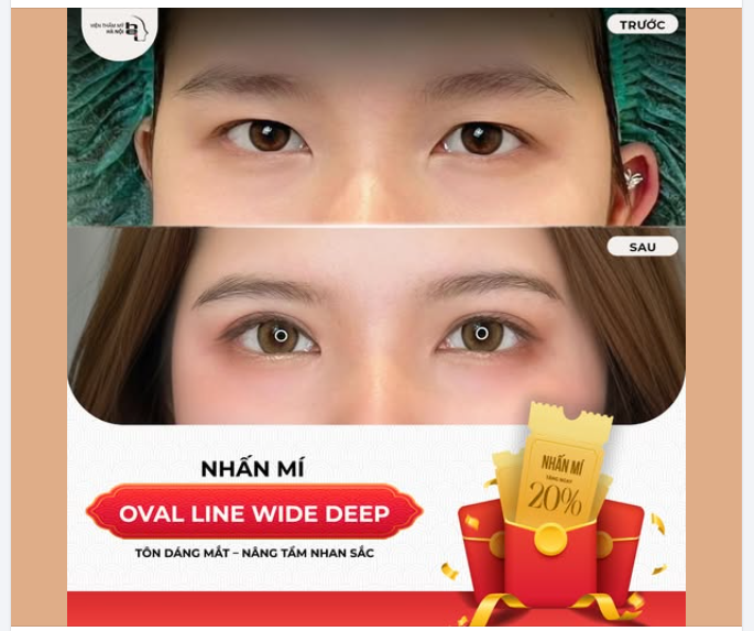 ĐỔI ĐÔI MẮT - ĐỔI THẦN THÁI  30 phút – mắt khác hẳn.