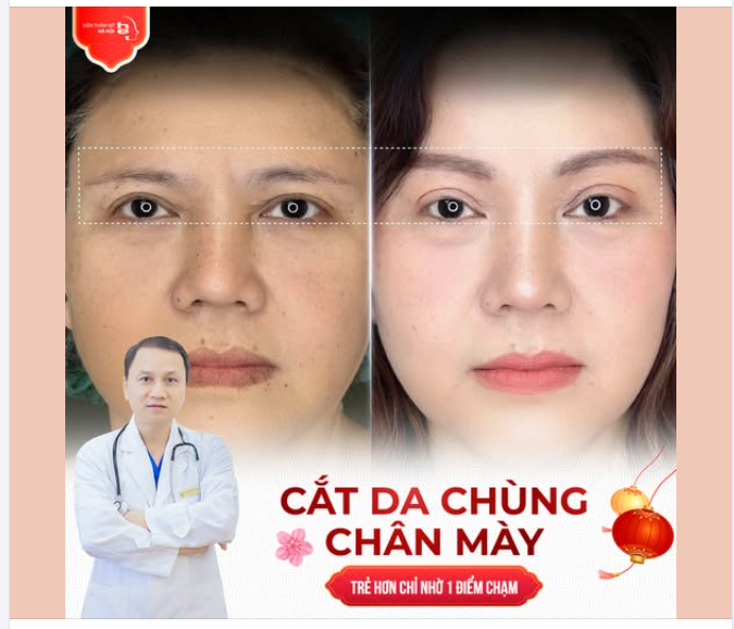 ĐỔI MẮT - ĐỐT TUỔI