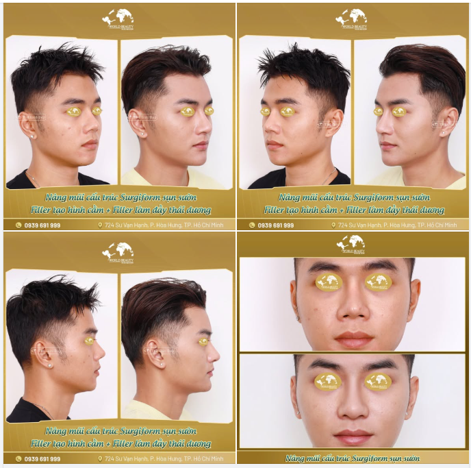 Một combo – Ba điểm chạm giúp gương mặt nam sắc nét và nam tính hơn