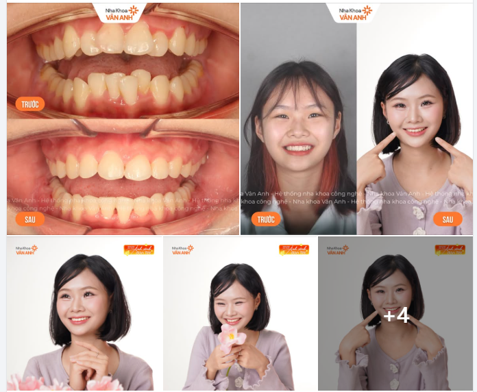 CHÀO ĐÓN NỤ CƯỜI MỚI – THÁO NIỀNG THÀNH CÔNG, RẠNG RỠ ĐÓN TẾT