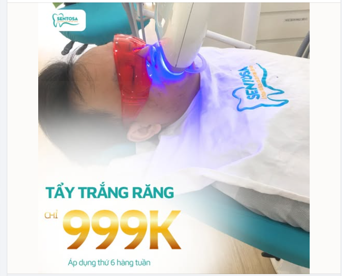 TẨY TRẮNG RĂNG ĐÓN TẾT – CHỈ 999.000Đ