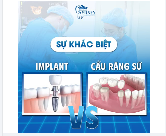 SỰ KHÁC BIỆT GIỮA IMPLANT VÀ CẦU RĂNG SỨ