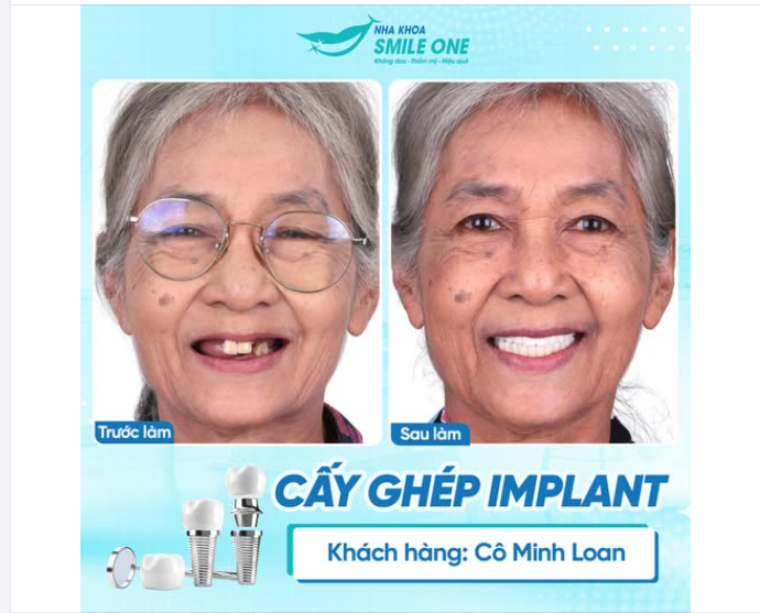 HÀNH TRÌNH TÌM LẠI NIỀM VUI TUỔI GIÀ CỦA CÔ MINH LOAN (85 TUỔI)