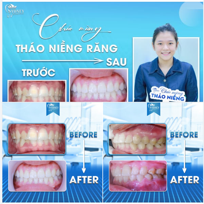 CHÚC MỪNG THÁO NIỀNG KH.LÊ HẰNG