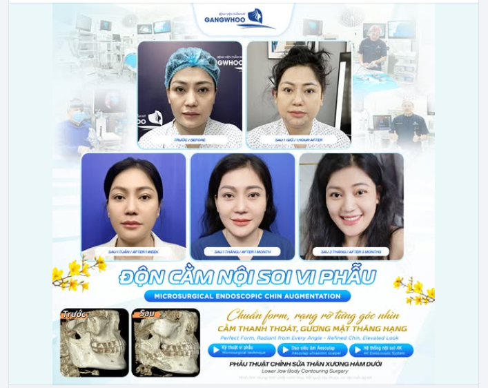 ĐỘN CẰM NỘI SOI VI PHẪU: CẰM THANH THOÁT, GƯƠNG MẶT THĂNG HẠNG – RẠNG RỠ TỪNG GÓC NHÌN