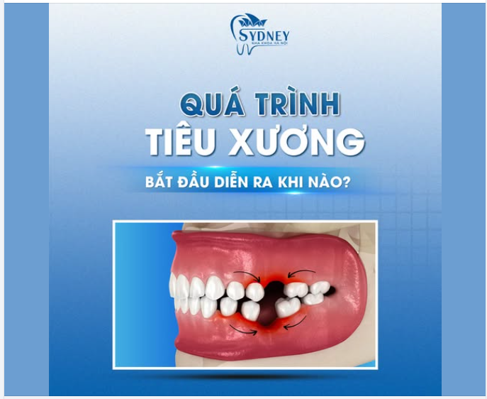 QUÁ TRÌNH TIÊU XƯƠNG BẮT ĐẦU DIỄN RA KHI NÀO?