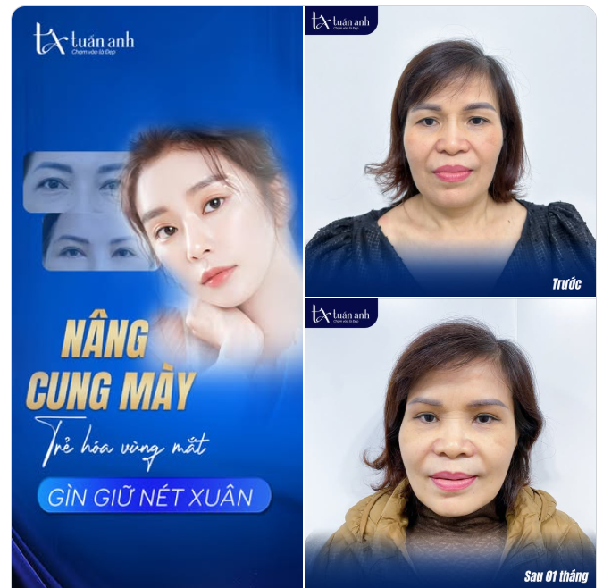 Chỉ cần lấy lại ánh nhìn tinh anh là cả gương mặt bừng sáng hẳn lên!