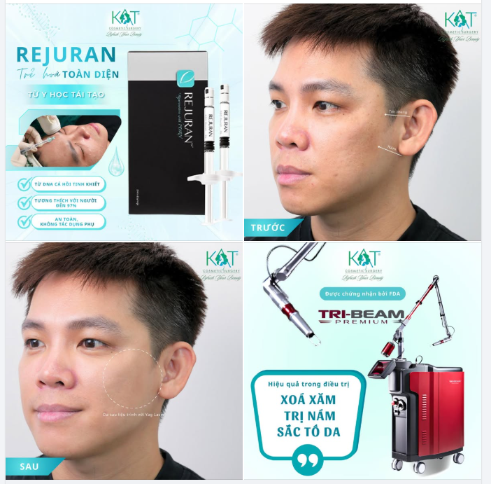 DA SÁNG – ĐỀU MÀU – NHÌN LÀ THẤY TRẺ HƠN