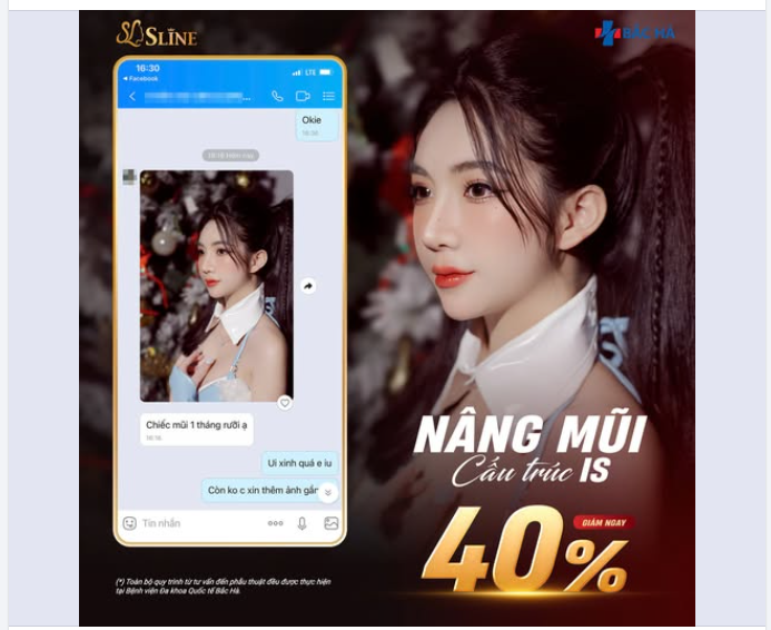 FEEDBACK NÂNG MŨI CẤU TRÚC SAU 1,5 THÁNG – FORM MŨI VÀO DÁNG RÕ RỆT