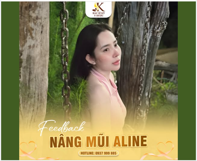 Aline - Dáng mũi tự nhiên hợp với mọi gương mặt