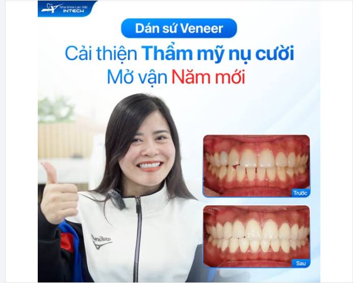 Một nụ cười đẹp không chỉ thay đổi diện mạo, mà còn mang đến sự tự tin, may mắn và những khởi đầu tích cực cho năm mới