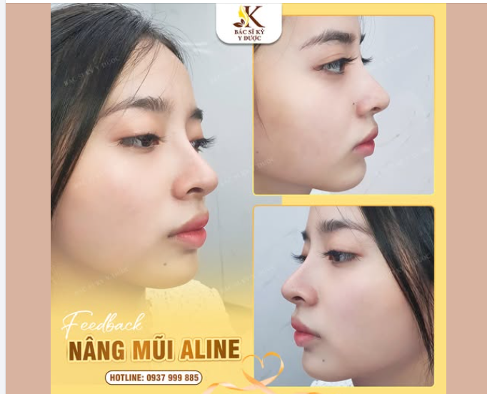 Điểm nhấn của một gương mặt xinh là dáng mũi hoàn hảo