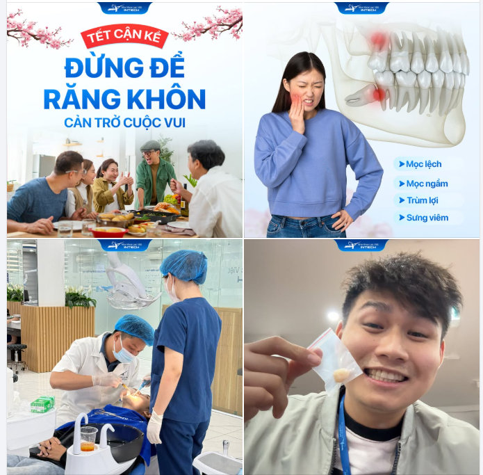 TẤT TOÁN RĂNG KHÔN - 5 TUẦN VÀNG ĐỂ KỊP LÀNH THƯƠNG ĐÓN TẾT