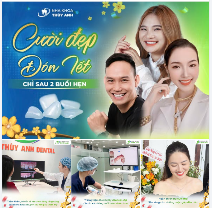 RĂNG SỨ THẨM MỸ – CƯỜI ĐẸP ĐÓN TẾT CHỈ TRONG 2 BUỔI HẸN