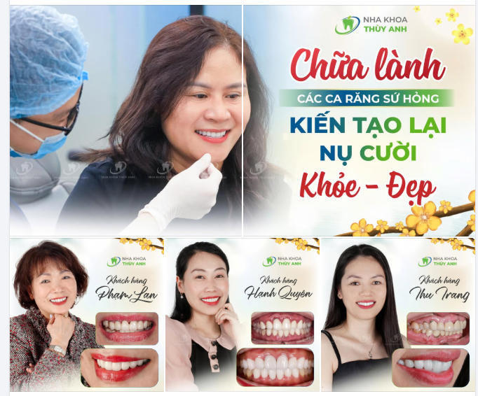 NHA KHOA THUỲ ANH 03 ĐỜI "CHỮA LÀNH" CÁC CASE RĂNG SỨ HỎNG