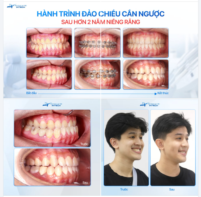 HÀNH TRÌNH ĐẢO CHIỀU CẮN NGƯỢC CỦA KHÁCH HÀNG NGUYỄN TIẾN DŨNG