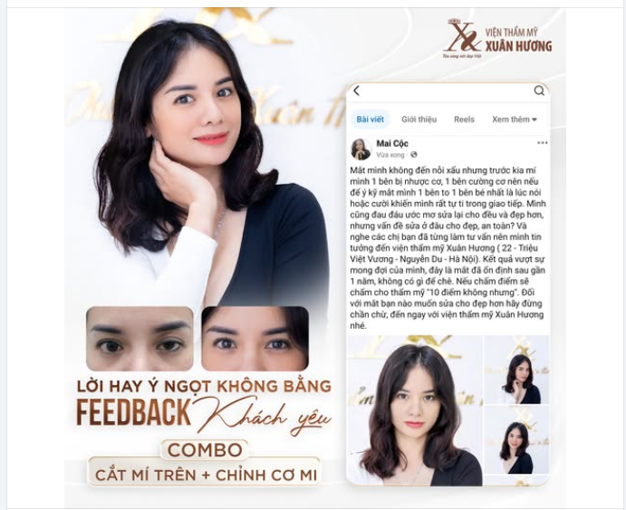 FEEDBACK KHÁCH HÀNG LÀM COMBO CẮT MÍ  CHỈNH CƠ MI TẠI VTM XUÂN HƯƠNG
