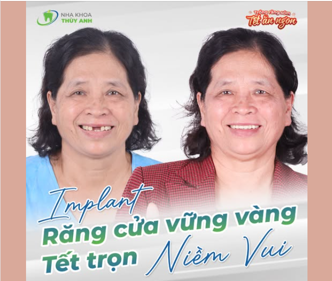 TẾT ĐẾN GẦN, RĂNG CỬA MẤT PHẢI LÀM SAO ĐỂ PHỤC HỒI NHANH- BỀN- VỮNG?