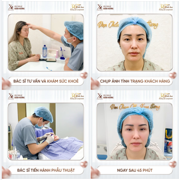 4 BƯỚC ĐỂ SỞ HỮU NGAY NẾP MÍ CỰC ĐẸP TẠI VTM XUÂN HƯƠNG