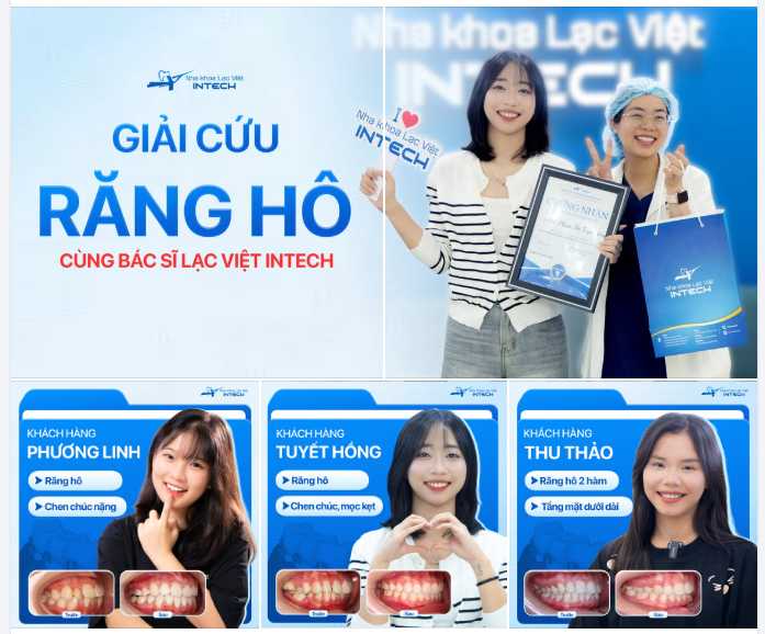 TẠM BIỆT RĂNG HÔ - "GIẢI CỨU" GÓC NGHIÊNG CÙNG BÁC SĨ LẠC VIỆT INTECH