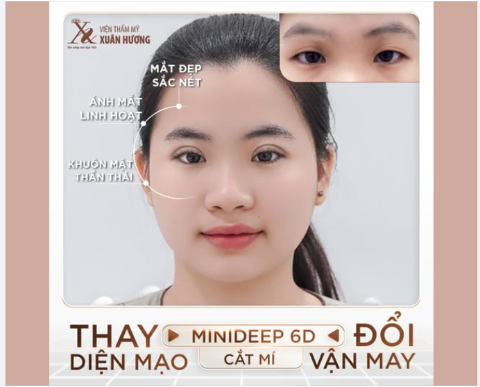 CẮT MÍ MINIDEEP 6D - THAY DIỆN MẠO, ĐỔI VẬN MAY