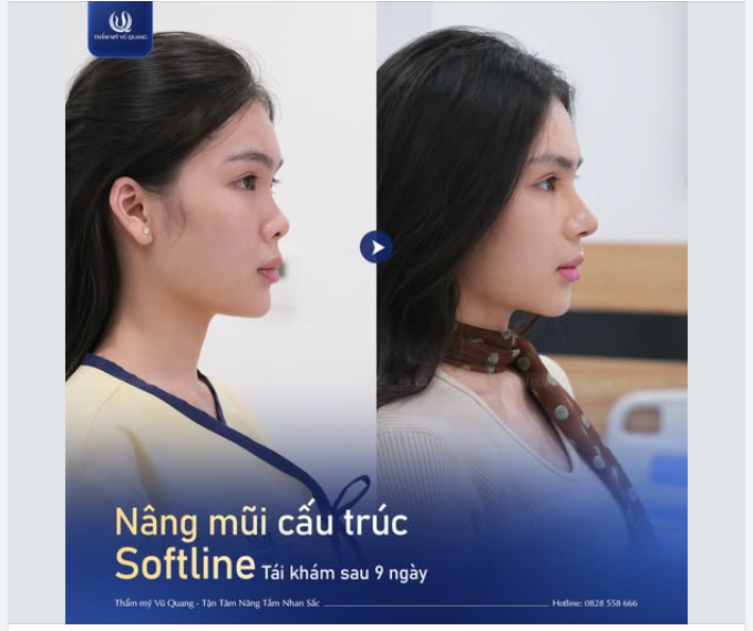 9 NGÀY THAY ĐỔI DIỆN MẠO – TỰ TIN GẤP BỘI