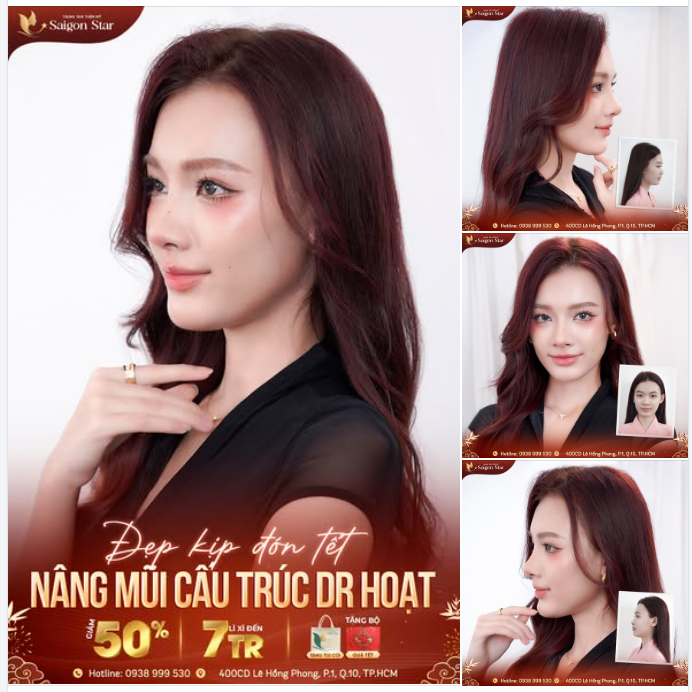 NÂNG MŨI CẤU TRÚC DR. HOẠT - ĐẸP KỊP ĐÓN TẾT