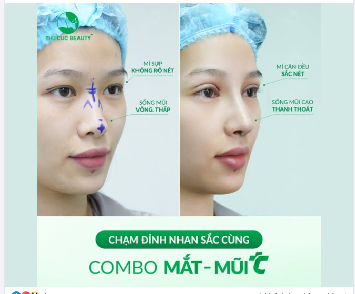 Chỉnh đúng hai điểm vàng trên gương mặt Thần thái bật sáng ngút ngàn