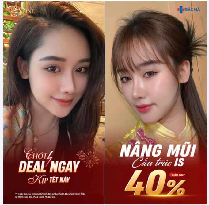 10 NGƯỜI NHANH TAY | GIM NGAY 40% NÂNG MŨI CẤU TRÚC Nếu bạn đang chờ “đúng thời điểm” để làm mũi, thì đây chính là lúc.