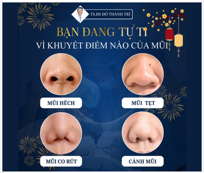 ĐỪNG ĐỂ CHIẾC MŨI "LỖI" LÀM LU MỜ NHAN SẮC CỦA BẠN!