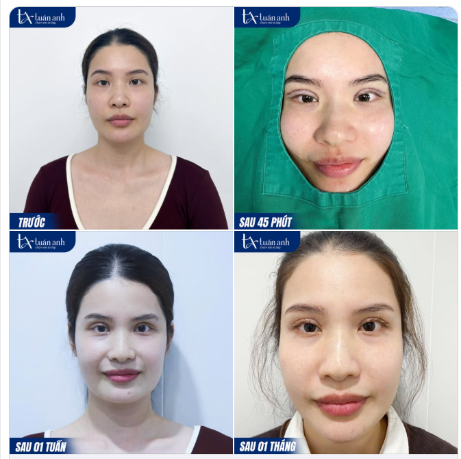 Tết này, hãy cho phép mình được tỏa sáng với phiên bản hoàn hảo và tự tin nhất nhé!