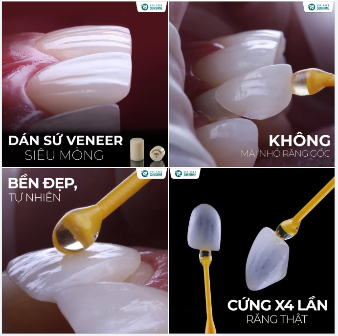 CHỈ CÒN HƠN 1 THÁNG NỮA ĐẾN TẾT – ĐỔI NỤ CƯỜI, ĐÓN TÀI LỘC