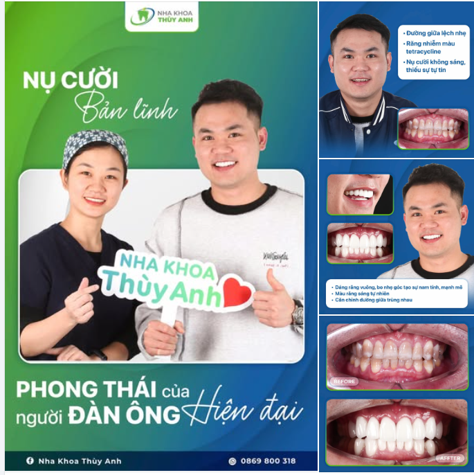 CÙNG CHUYÊN GIA ĐỒNG HÀNH – KIẾN TẠO NỤ CƯỜI BẢN LĨNH CỦA PHÁI MẠNH