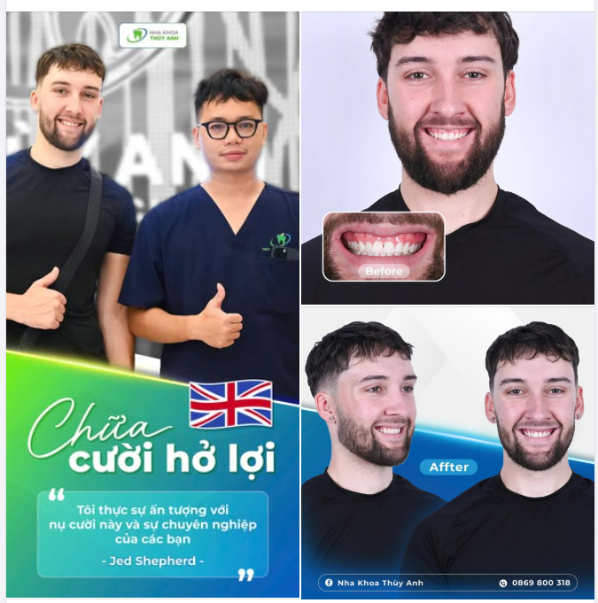 PHONG THÁI TỰ TIN KHI NỤ CƯỜI THỰC SỰ ĐƯỢC ''GIẢI PHÓNG''
