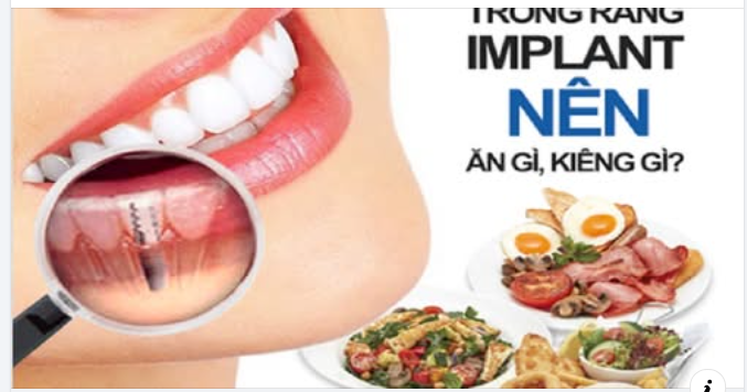 Trồng răng implant bao lâu thì ăn được?