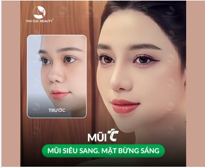 Nhan sắc thăng hạng chỉ sau 1 quyết định